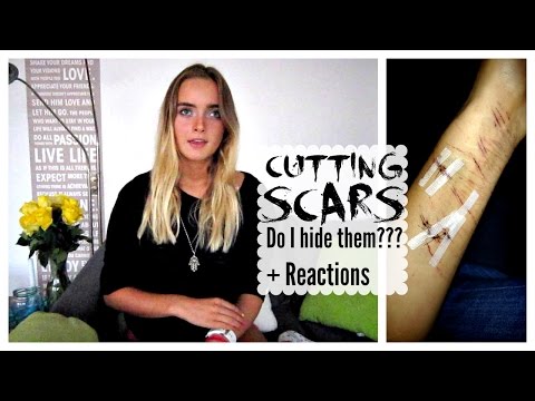 SELF HARM: Do I Hide My Scars? | Jilicious Journey