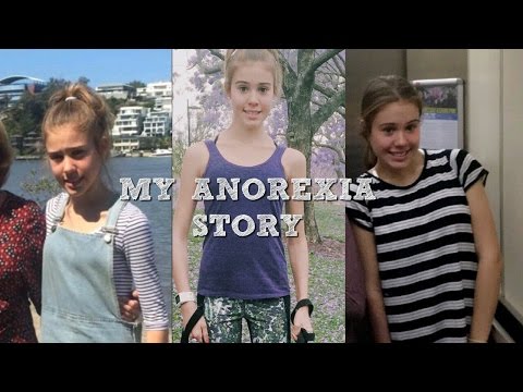 My Anorexia story